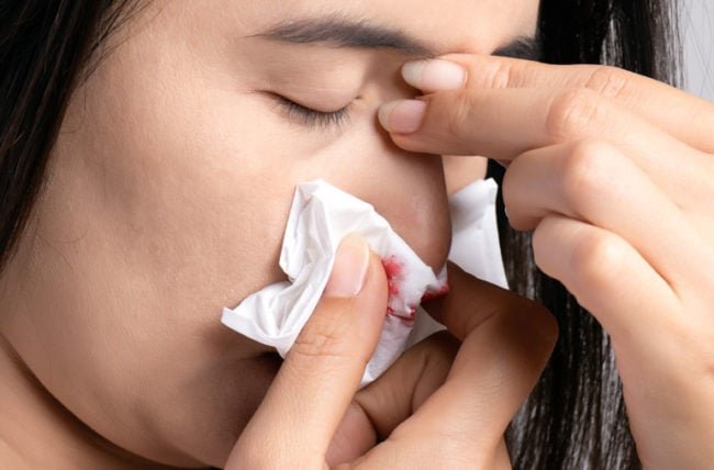 Can Air Conditioner Cause Nosebleeds? Unveiling The Surprising Link
